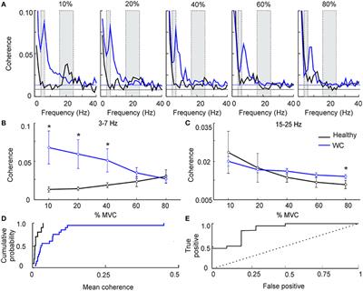 Abnormal Blink Reflex and Intermuscular Coherence in Writer's Cramp